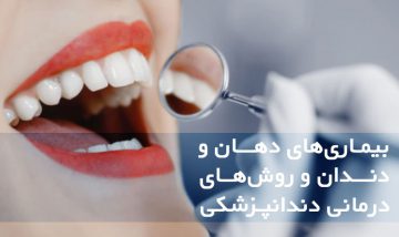 بیماری‌های دهان و دندان و روش‌های درمانی دندانپزشکی