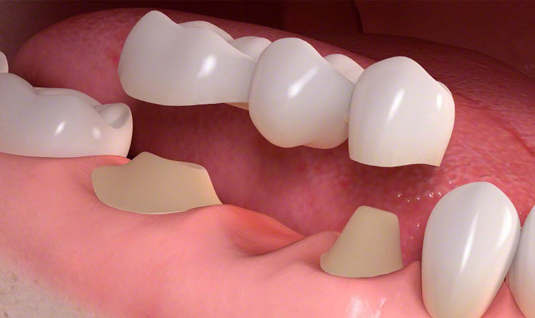 بیماری‌های دهان و دندان و روش‌های درمانی دندانپزشکی
